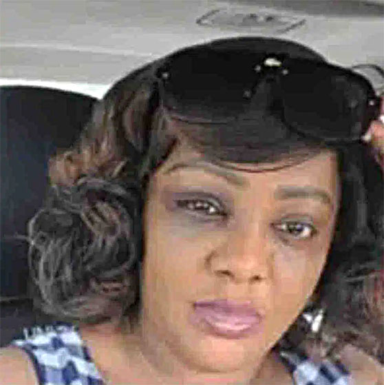 Helen Paul Black Eye