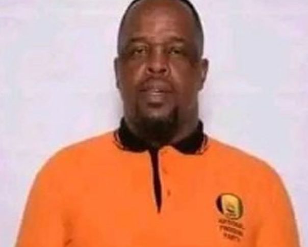 South African Man Burnt By Wife